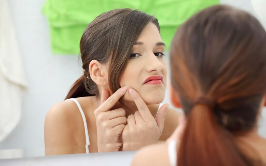 The Link Between Spicy Food and Acne